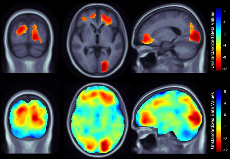 File:SOCR Events FTO Obesity Neuroimaging2010 F1.png